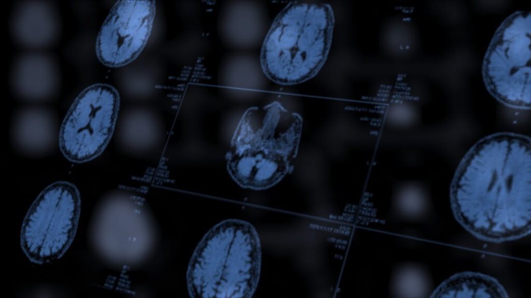 Healing The Gut Can Reduce Long-Term Impact of Stroke, Research Spearheaded by Texas A&M Graduate Student Finds teaser image